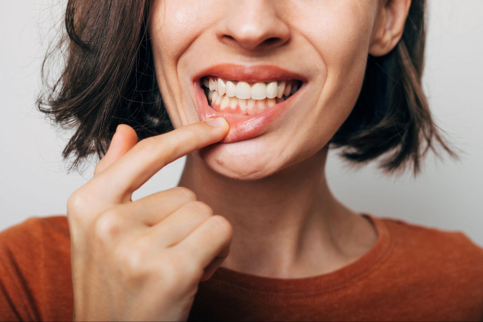 Symptoms of Chronic Gum Disease