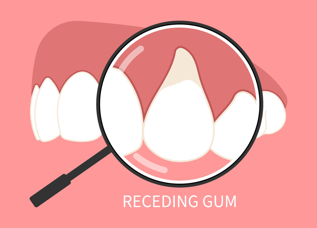 injury teeth pain dentistry crown prep cosmetic recontouring procedure oral recession gummy smile root canal decay toothache swelling grafting for buildup Loose black cavity abscess thin