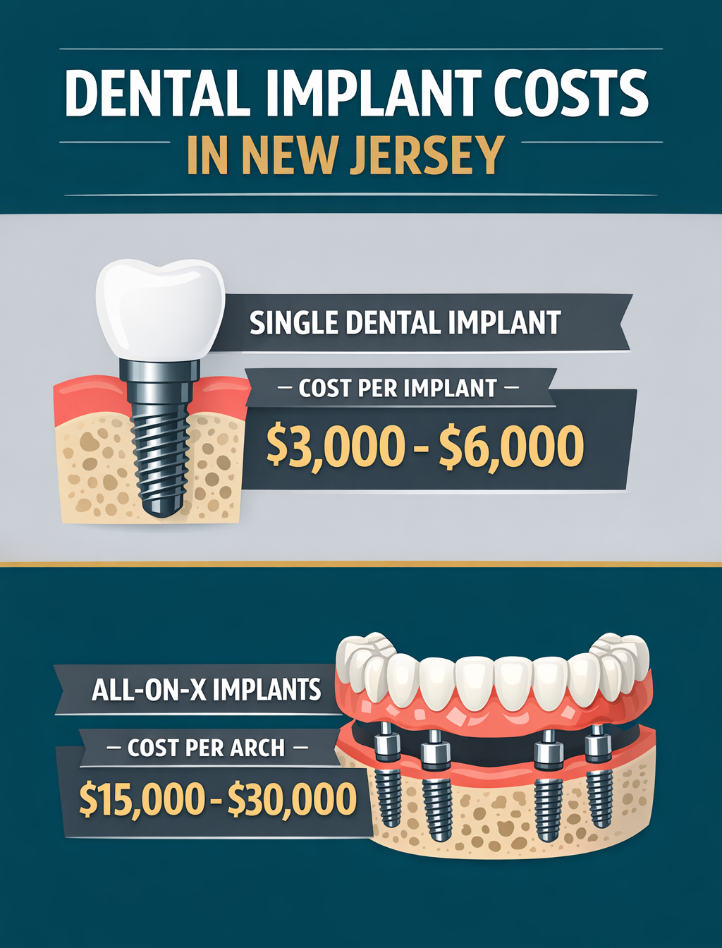 Single vs Full Arch Implant Costs