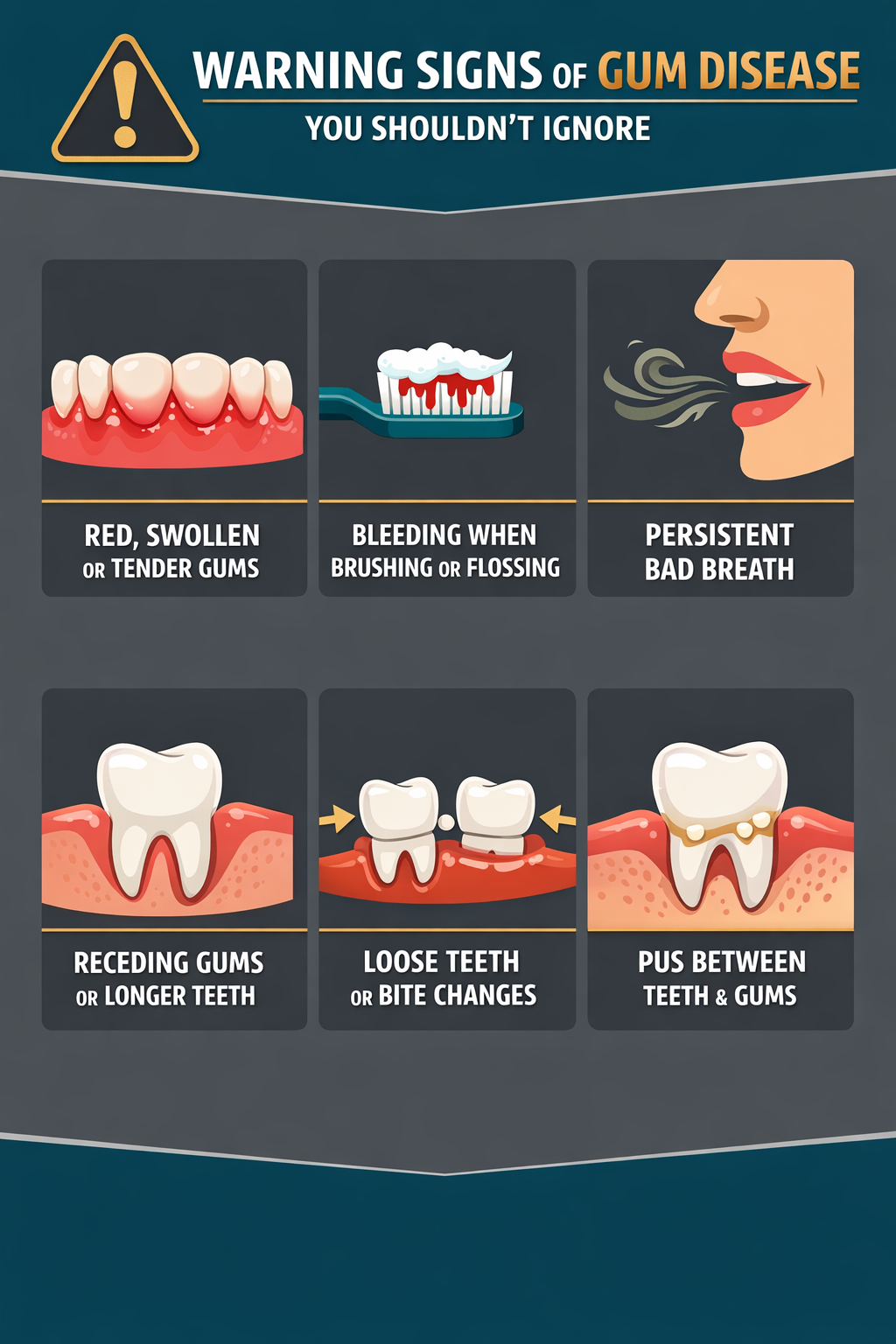 Warning Signs of Gum Disease