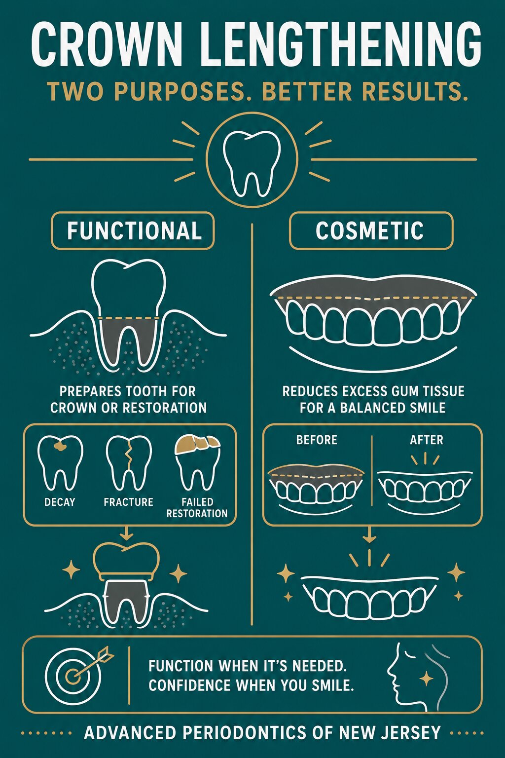 Infographic_Crown Lengthening When Is It Necessary and What Does Recovery Look Like